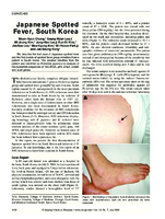 Japanese Spotted Fever South Korea