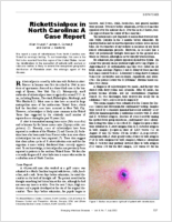 Rickettsialpox in North Carolina A Case Report