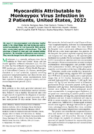 Myocarditis Attributable to Monkeypox Virus Infection in 2 Patients United States 2022
