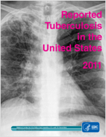 Reported Tuberculosis in the United States 2011