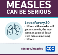 Measles Can be Serious Pneumonia