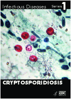 Cryptosporidiosis