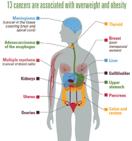 13 cancers are associated with overweight and obesity
