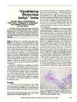 Candidatus Rickettsia kellyi India