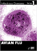 Avian flu