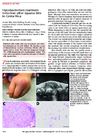 Mycobacterium marinum Infection after Iguana Bite in Costa Rica
