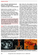 Case Report and Literature Review of Prosthetic Cardiovascular Mucormycosis