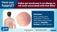 Have You Heard Alphagal Syndrome Is an Allergy to Red Meat Associated Tick Bites