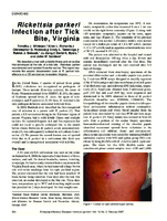Rickettsia parkeri Infection after Tick Bite Virginia