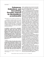 Cutaneous Melioidosis and Necrotizing Fasciitis Caused by Burkholderia pseudomallei