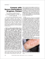 Cowpox with Severe Generalized Eruption Finland
