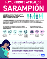 Hay un Brote Actual de Sarampin