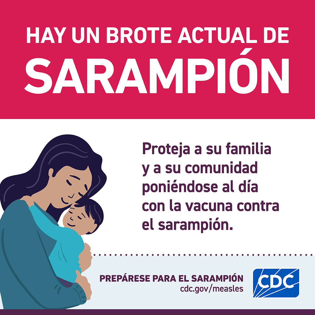 Hay un Brote Actual de Sarampión [gráfico en redes sociales]