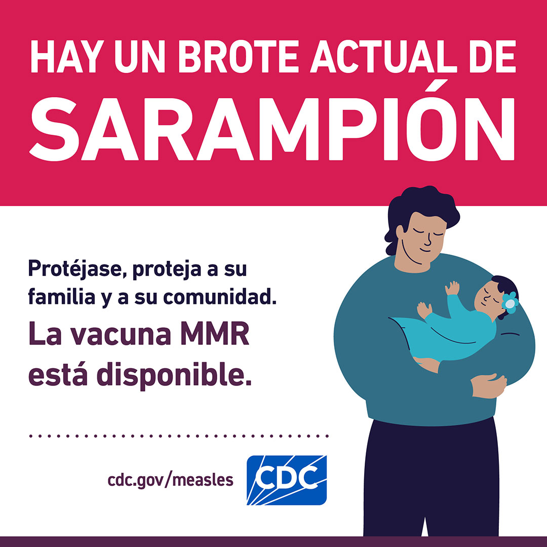 Hay un Brote Actual de Sarampión: La vacuna MMR esta Disponible [gráfico en redes sociales]