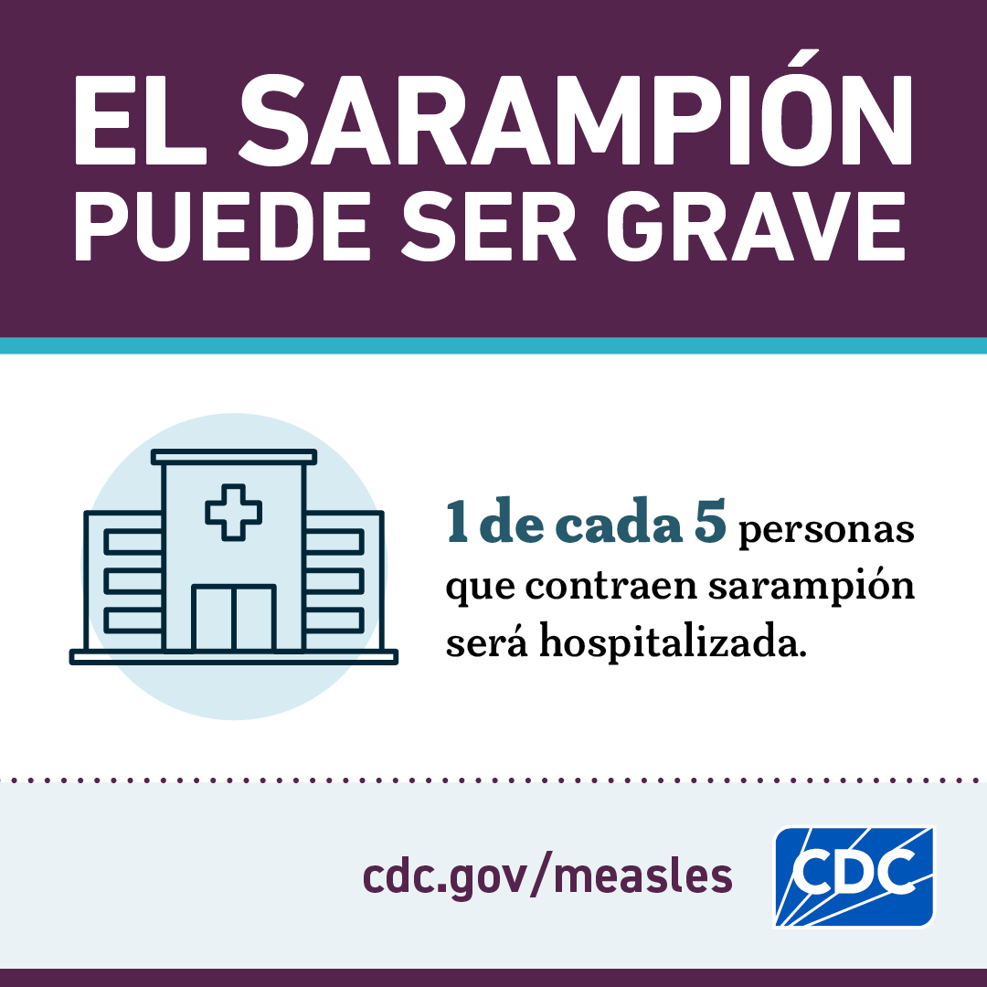 El Sarampión puede ser grave: Hospitalización