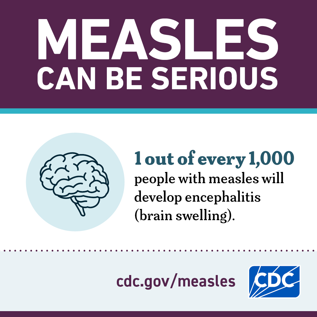 Measles Can be Serious: Brain Swelling