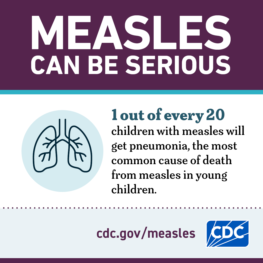 Measles Can be Serious: Pneumonia
