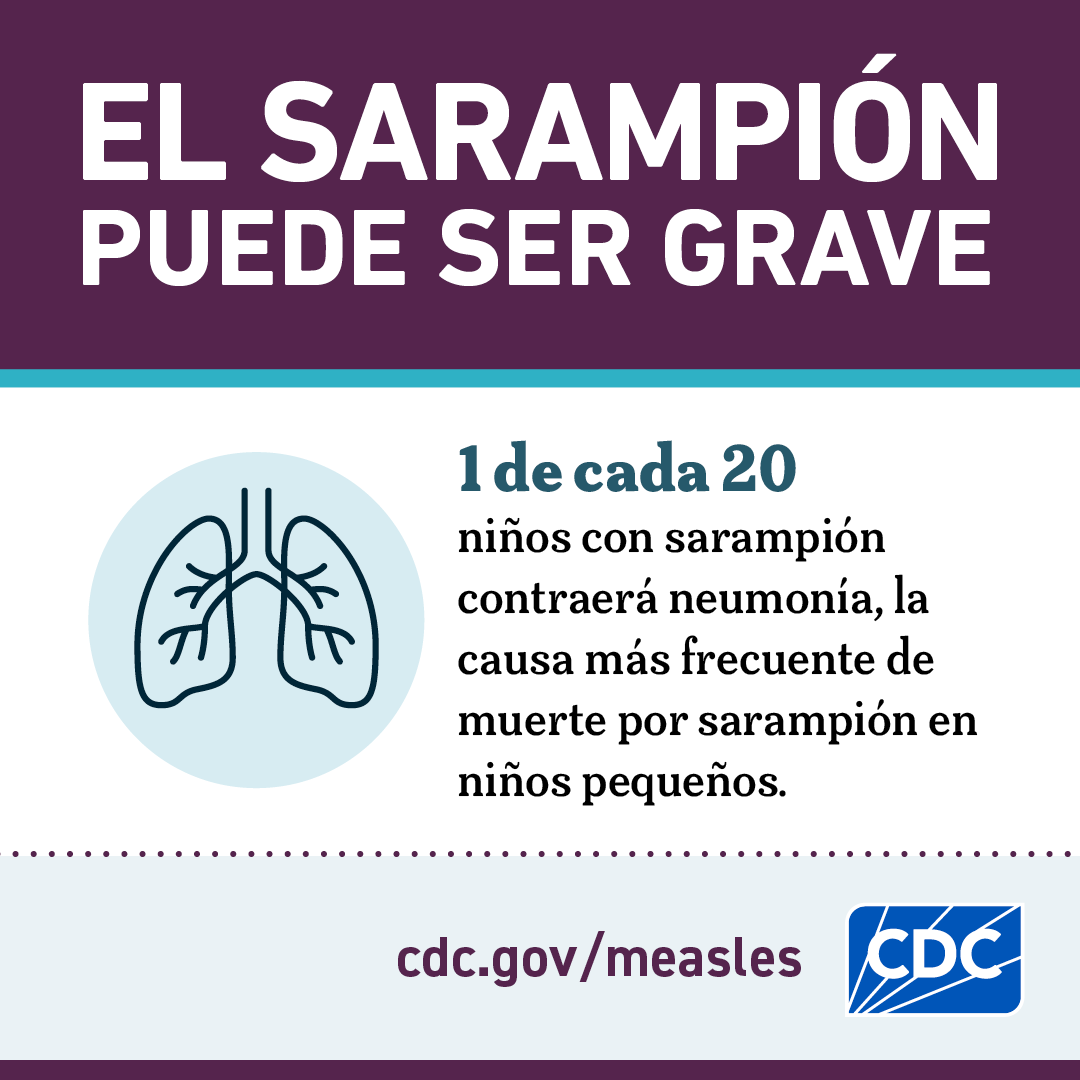 El Sarampión puede ser grave: Neumonía