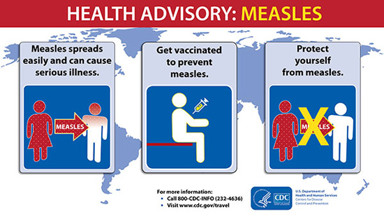 Health advisory : Measles [before travelling]