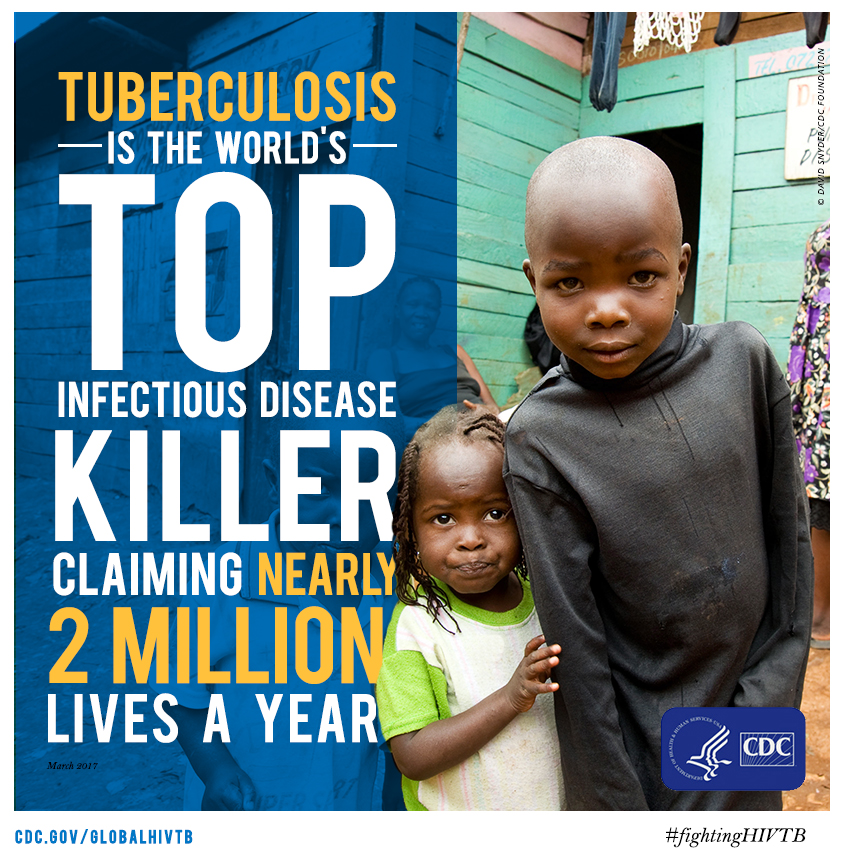 Tuberculosis is the world's top killer, claiming nearly 2 million lives a year