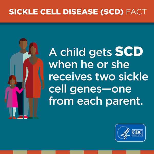 A child gets SCD when he or she receives two sickle cell genes-one from each parent