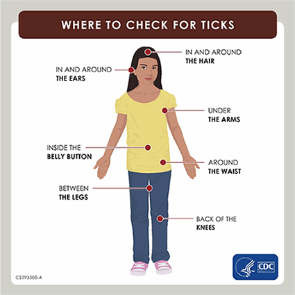 Where to check for ticks